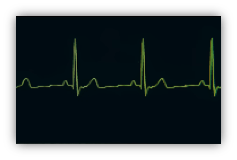 "Close-up of a green ECG heart rate monitor display showing rhythmic heartbeats."